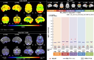 脳血流シンチ（機能解析画像）の画像