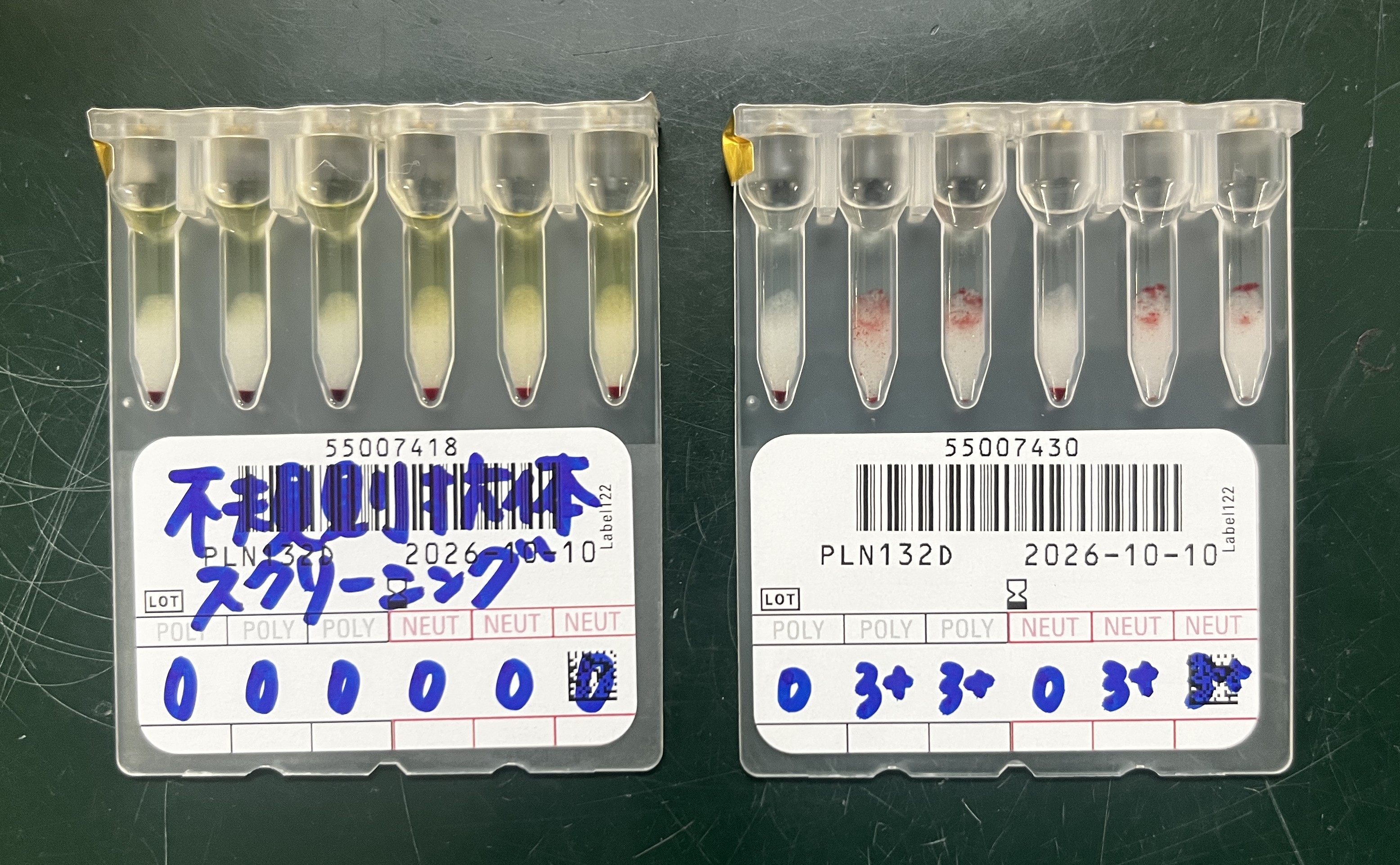 不規則抗体スクリーニング
