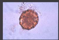 ​回虫卵（60×50ミクロン）の画像