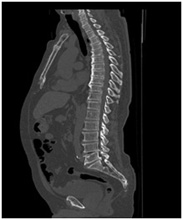 脊椎の画像2