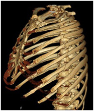 脊椎の画像3