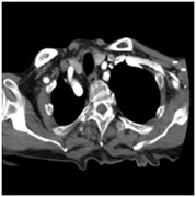 鎖骨下動脈CT-Angioの画像1