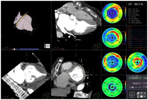 心臓CT検査の画像5