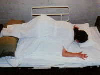 IVH・DIV・バルーン留置患者への応用の画像