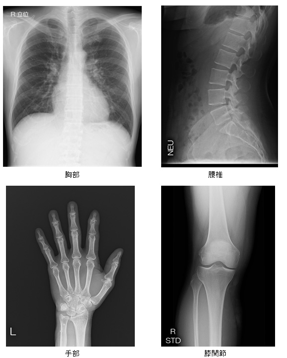 一般撮影（胸部、腰椎、手部、膝関節）の画像